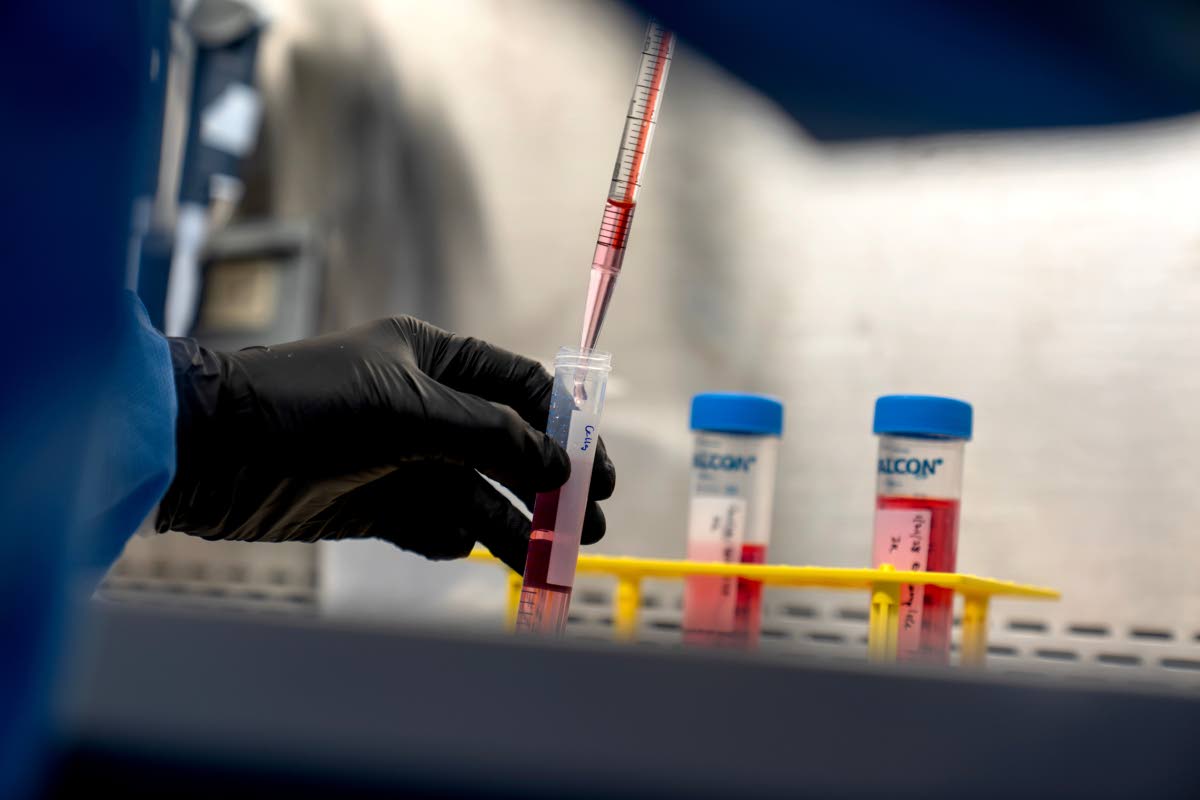 Dr Justin Kwong, a research fellow who coaxes human stem cells to grow into a kind of immune cell involved in autoimmune diseases, works in a lab at the National Institutes of Health in Bethesda, Maryland.