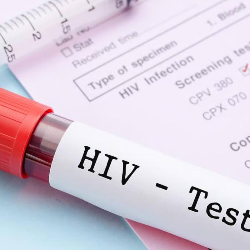 HIV testing surges amid social media discussion