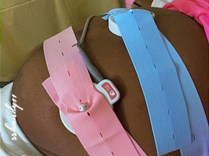 Monitoring devices connected to Shandale Ballentine during her recent stay at the Cornwall Regional Hospital to give birth. 