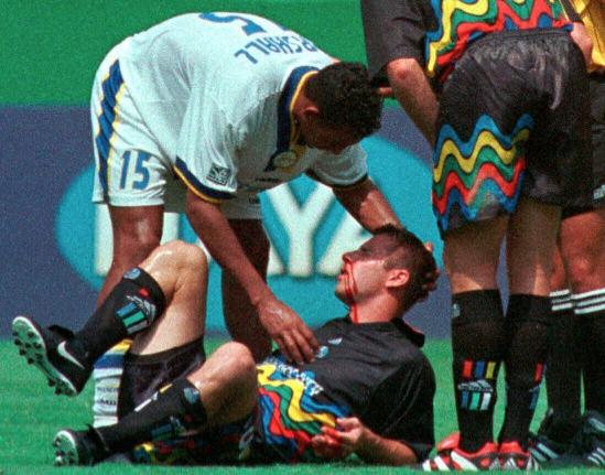 Former Reggae Boy and Miami Fusion’s Tyrone Marshall (15) assists Kansas City Wizards’ Scott Vermillion after the two collided while going up for a header in the first half of a football match on August 29, 1999, in Kansas City, Missouri.
